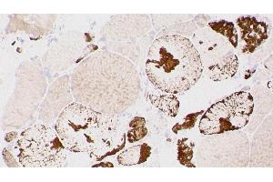 Immunohistochemistry (IHC) image for anti-Myotilin (MYOT) (C-Term) antibody (ABIN7538828) (Myotilin anticorps  (C-Term))