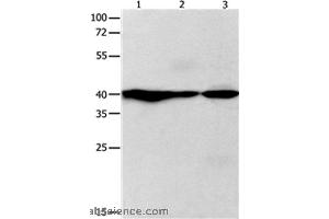 Western blot analysis of Human fetal brain and brain malignant glioma, mouse brain tissue, using GNAZ Polyclonal Antibody at dilution of 1:400 (GNaZ anticorps)