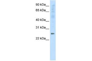WB Suggested Anti-SNAP25 Antibody Titration:  0. (SNAP25 anticorps  (C-Term))