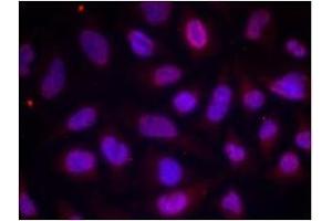 Image no. 1 for anti-Myocyte Enhancer Factor 2A (MEF2A) (pThr312) antibody (ABIN196683) (MEF2A anticorps  (pThr312))