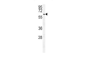 Western Blotting (WB) image for anti-Ubiquitin Specific Peptidase 17-Like Family Member 24 (USP17L24) (AA 496-524), (C-Term) antibody (ABIN651682)