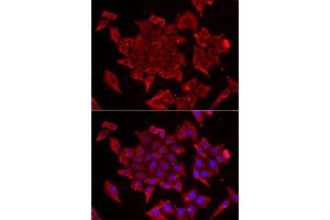 Immunofluorescence analysis of U2OS cells using TIMM17A antibody. (TIMM17A anticorps  (AA 1-171))