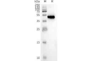 Western Blotting (WB) image for Chemokine (C-C Motif) Receptor 8 (CCR8) protein (ABIN7491570)