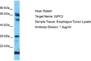 Host: Rabbit Target Name: GIPC2 Sample Type: Esophagus Tumor lysates Antibody Dilution: 1. (GIPC2 anticorps  (C-Term))