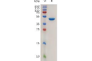 Human Protein, hFc Tag on SDS-PAGE under reducing condition. (AGR2 Protein (AA 21-175) (Fc Tag))