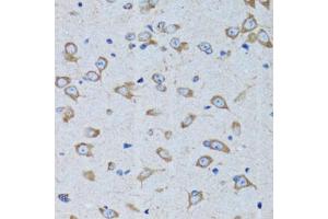 Immunohistochemistry of paraffin-embedded rat brain using RARS antibody. (RARS anticorps)