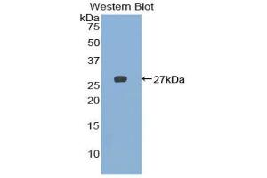 Western blot analysis of recombinant Rat NKR2B4. (2B4 anticorps  (AA 20-221))