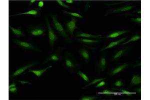 Immunofluorescence of monoclonal antibody to CALCOCO2 on HeLa cell. (CALCOCO2 anticorps  (AA 347-446))