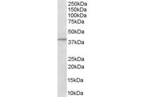 Western Blotting (WB) image for anti-ArfGAP with Dual PH Domains 1 (ADAP1) (C-Term) antibody (ABIN2465521) (ADAP1 anticorps  (C-Term))