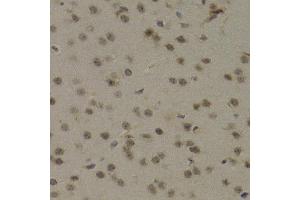 Immunohistochemistry of paraffin-embedded mouse brain using PAWR Antibody (ABIN5971565) at dilution of 1/200 (40x lens). (PAWR anticorps)