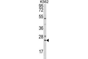 Western Blotting (WB) image for anti-RAB7A, Member RAS Oncogene Family (RAB7A) antibody (ABIN3003858) (RAB7A anticorps)