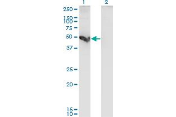 Cathepsin E anticorps  (AA 18-396)