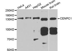 Western blot analysis of extracts of various cell lines, using CENPC antibody (ABIN5973936) at 1/1000 dilution. (Centromere Protein C Pseudogene 1 (CENPCP1) anticorps)
