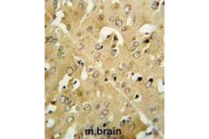 Immunohistochemistry (IHC) image for anti-Corticotropin Releasing Hormone Receptor 2 (CRHR2) antibody (ABIN3002799) (CRHR2 anticorps)