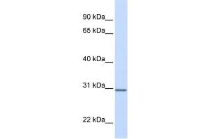 WB Suggested Anti-DCI Antibody Titration:  0. (DCI anticorps  (N-Term))