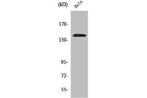 Western Blot analysis of Hela cells using PERK Polyclonal Antibody (PERK anticorps  (N-Term))