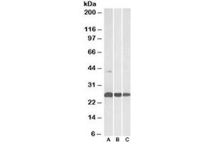 Western blot testing of human [A], mouse [B] and rat [C] heart lysates with DUSP6 antibody at 0. (DUSP6 anticorps)