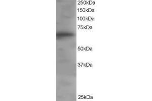 Western Blotting (WB) image for anti-Docking Protein 3 (DOK3) (C-Term) antibody (ABIN2465609) (DOK3 anticorps  (C-Term))