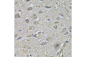 Immunohistochemistry of paraffin-embedded human brain cancer using WIPI1 Antibody (ABIN2560779) at dilution of 1:100 (40x lens). (WIPI1 anticorps)