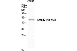 Western Blot analysis of COLO cells using Smad2 Polyclonal Antibody diluted at 1:1000. (SMAD2 anticorps)