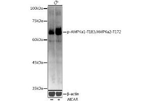 Western blot analysis of extracts of C6 cells, using Phospho-AMPKa1-T183/AMPKa2-T172 antibody (ABIN3020441, ABIN3020442, ABIN3020443 and ABIN1681942) at 1:1000 dilution. (AMPK alpha anticorps  (pThr172))