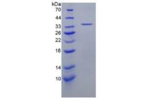 SDS-PAGE (SDS) image for Chemokine (C-X-C Motif) Ligand 5 (CXCL5) ELISA Kit (ABIN6730954)