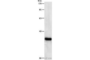 Western blot analysis of Hela cell, using PCNA Polyclonal Antibody at dilution of 1:500 (PCNA anticorps)