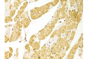 Immunohistochemistry of paraffin-embedded rat heart using PLCB1 antibody (ABIN5971022) at dilution of 1/100 (40x lens). (Phospholipase C beta 1 anticorps)