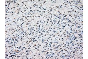 Immunohistochemical staining of paraffin-embedded Ovary tissue using anti-KRT8mouse monoclonal antibody. (KRT8 anticorps  (AA 91-381))