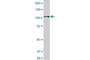 HK2 monoclonal antibody (M01), clone 4H1. (Hexokinase 2 anticorps  (AA 818-917))