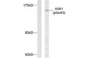Western blot analysis of extracts from MDA-MB-435 cells treated with TNF-alpha, using ASK1 (Phospho-Ser83) Antibody. (ASK1 anticorps  (pSer83))