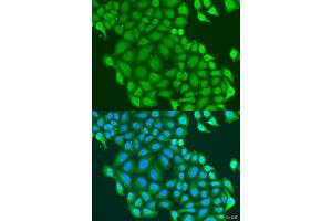 Immunofluorescence analysis of U2OS cells using HAUS6 antibody (ABIN1872650) at dilution of 1:100. (FAM29A anticorps)