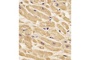 Immunohistochemistry (Paraffin-embedded Sections) (IHC (p)) image for anti-Actin, beta (ACTB) antibody (ABIN658990)