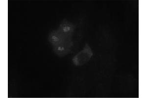 Image no. 1 for anti-Budding Uninhibited By Benzimidazoles 1 Homolog (Yeast) (BUB1) antibody (ABIN341032) (BUB1 anticorps)