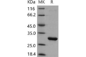 Western Blotting (WB) image for Hydroxyprostaglandin Dehydrogenase 15-(NAD) (HPGD) (Active) protein (His tag) (ABIN7320244) (HPGD Protein (His tag))