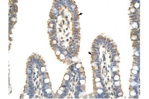 ANAPC7 antibody was used for immunohistochemistry at a concentration of 4-8 ug/ml to stain Epithelial cells of intestinal villus (arrows) in Human Intestine. (ANAPC7 anticorps  (C-Term))