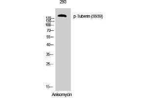 Western Blotting (WB) image for anti-Tuberous Sclerosis 2 (TSC2) (pSer939) antibody (ABIN3182562) (Tuberin anticorps  (pSer939))