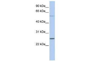 SCN1B antibody used at 1 ug/ml to detect target protein. (SCN1B anticorps  (Middle Region))