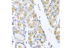 Immunohistochemistry of paraffin-embedded human stomach using TMEM43 antibody. (TMEM43 anticorps)