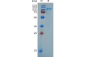 SLC4A7 Protein (AA 1-608) (His tag)