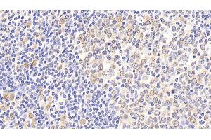 Detection of HSPA8 in Human Tonsil Tissue using Polyclonal Antibody to Heat Shock 70 kDa Protein 8 (HSPA8) (Hsc70 anticorps  (AA 534-615))