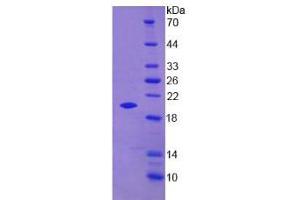 SDS-PAGE analysis of Mouse PGLYRP1 Protein. (PGLYRP1 Protéine)