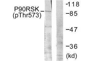 Western blot analysis of extracts from 293 cells treated with UV using p90 RSK (Phospho-Thr573) Antibody. (RPS6KA1 anticorps  (pThr573))