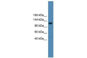 DGKQ antibody used at 0. (DGKQ anticorps  (Middle Region))