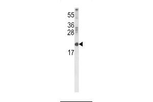 Western blot analysis of RBP2 Antibody in 293 cell line lysates (35ug/lane) (RBP2 anticorps  (AA 56-84))