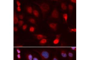 Immunofluorescence analysis of U2OS cells using ATP7B Polyclonal Antibody (ATP7B anticorps)