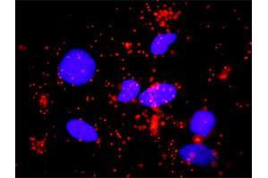 Proximity Ligation Assay (PLA) image for anti-SMAD, Mothers Against DPP Homolog 3 (SMAD3) (AA 120-221) antibody (ABIN561715)