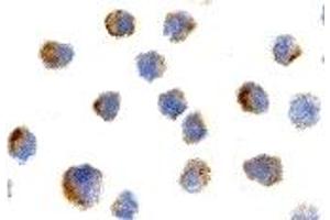 Immunohistochemistry (IHC) image for anti-Nerve Growth Factor Receptor (NGFR) antibody (ABIN1031777) (NGFR anticorps)