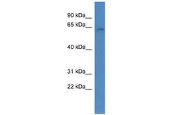 ARID3B anticorps  (AA 426-475)