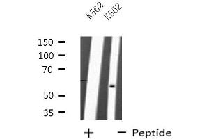 Western blot analysis of extracts from K562 cells, using TRAF2 antibody. (TRAF2 anticorps  (C-Term))